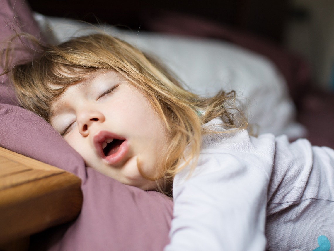 Obstructive Sleep Apnea in Children