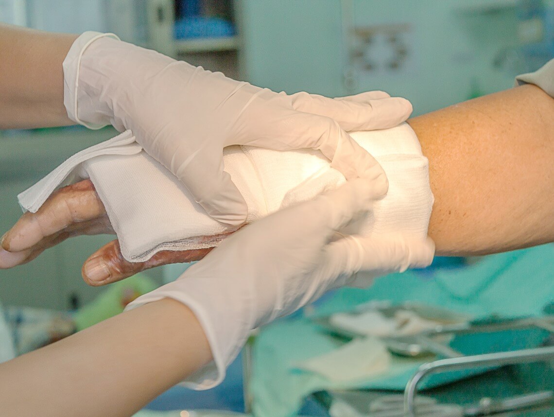 How to Change a Wound Dressing