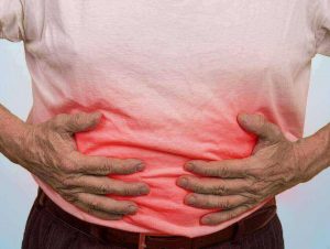 Crohn's Disease