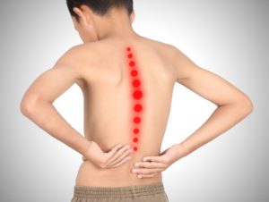 Hyperlordosis in Children