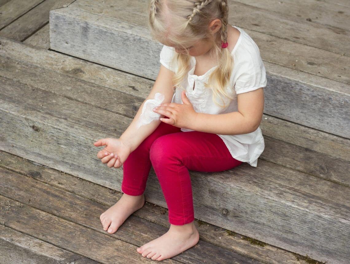 Eczema in Children